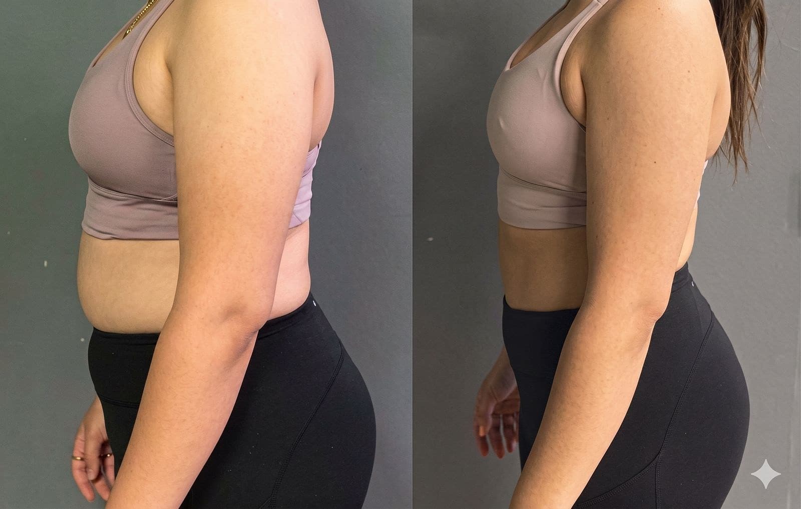 MetaFit member transformation on a doctor-led tirzepatide (Mounjaro) program